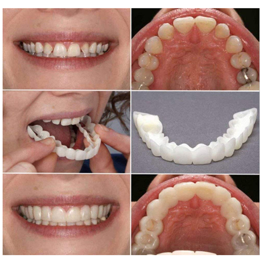 ライコン義歯セットフィット一時的な矯正歯義歯偽歯口腔衛生ケア - Teeth Whitening Usa のレビューと価格