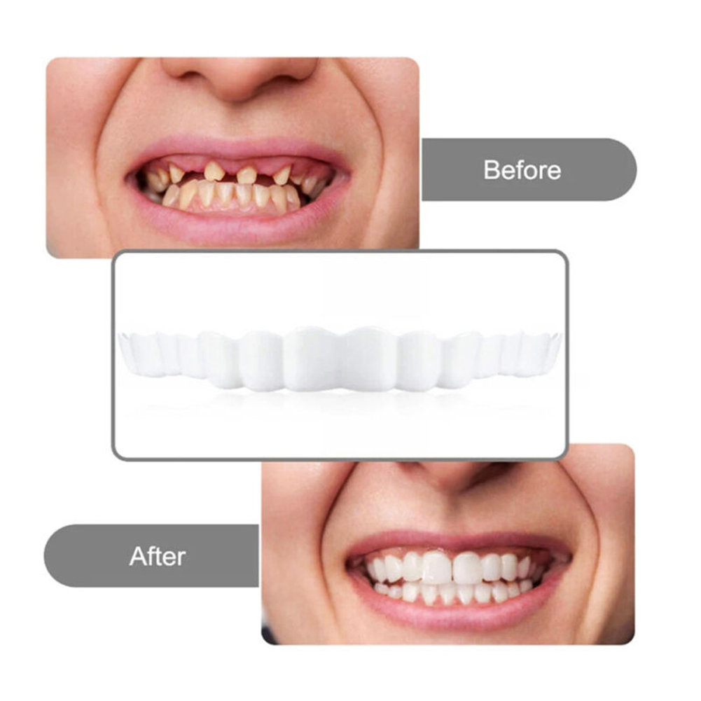 ライコン義歯セットフィット一時的な矯正歯義歯偽歯口腔衛生ケア - Teeth Whitening Usa のレビューと価格