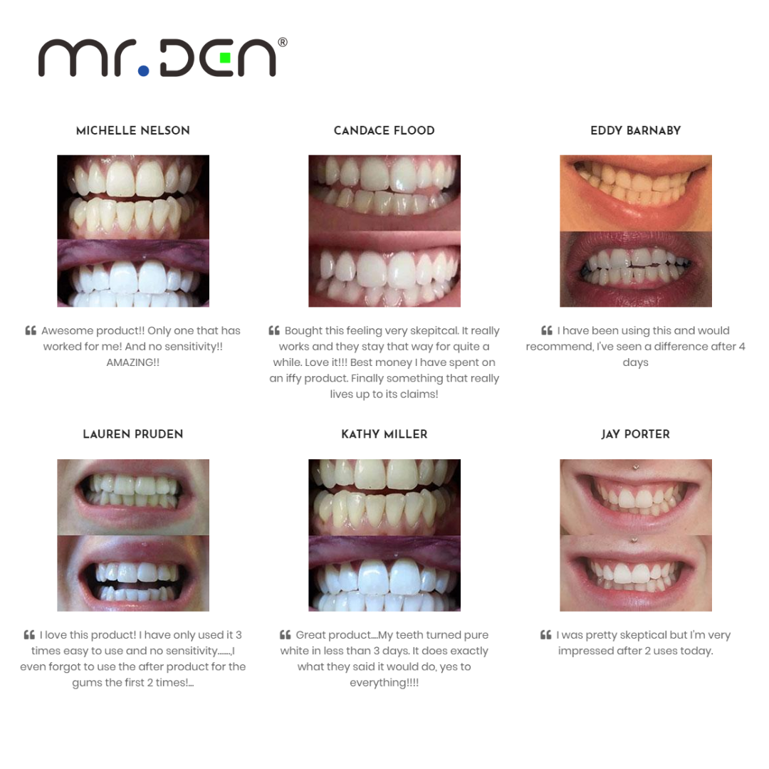ドクターホワイトン 3パック 歯のホワイトニングキット プロ - Teeth Whitening With Light のレビューと価格