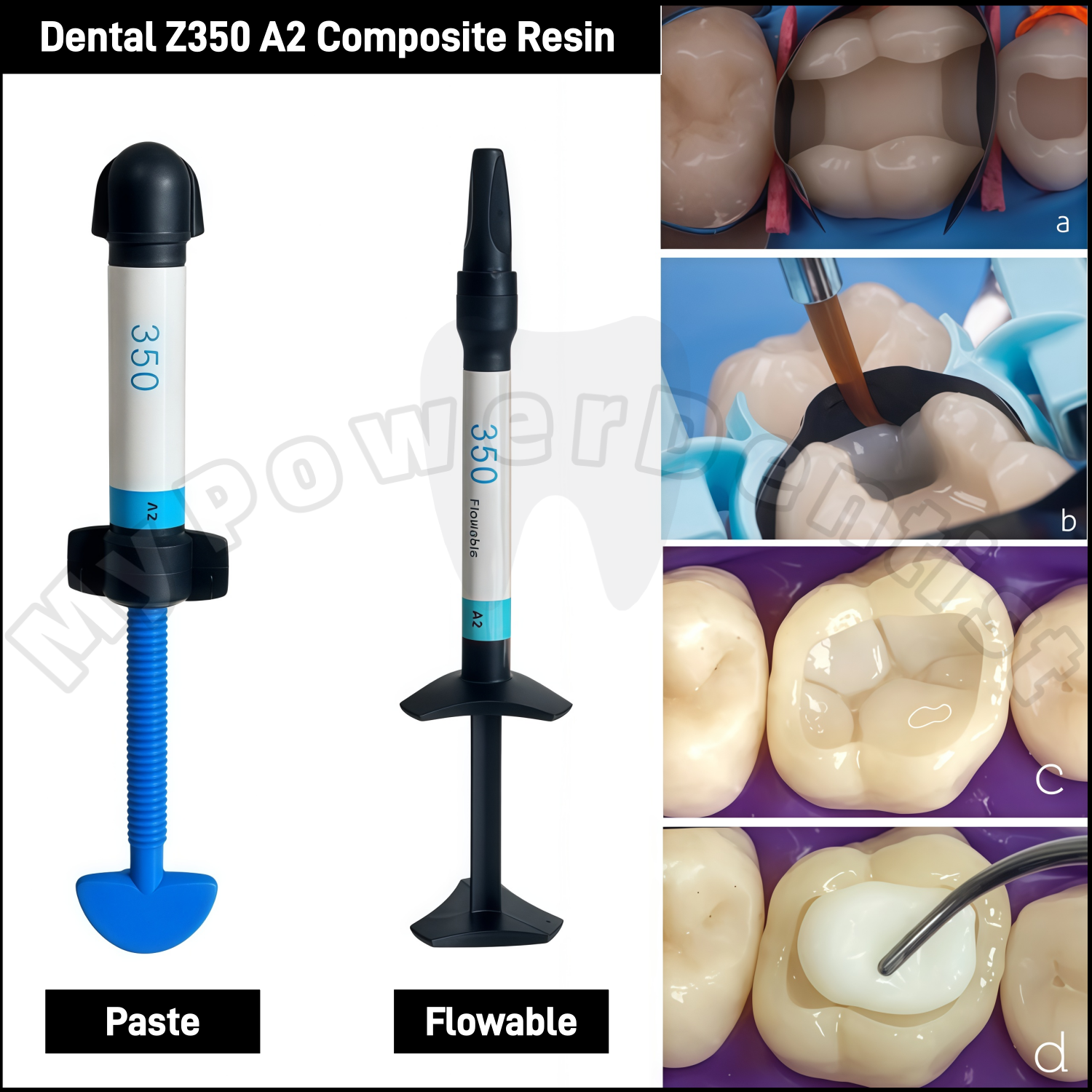 Z350 A2 歯科用コンポジットレジン光重合ベニアホワイト - Teeth Whitening With Light のレビューと価格
