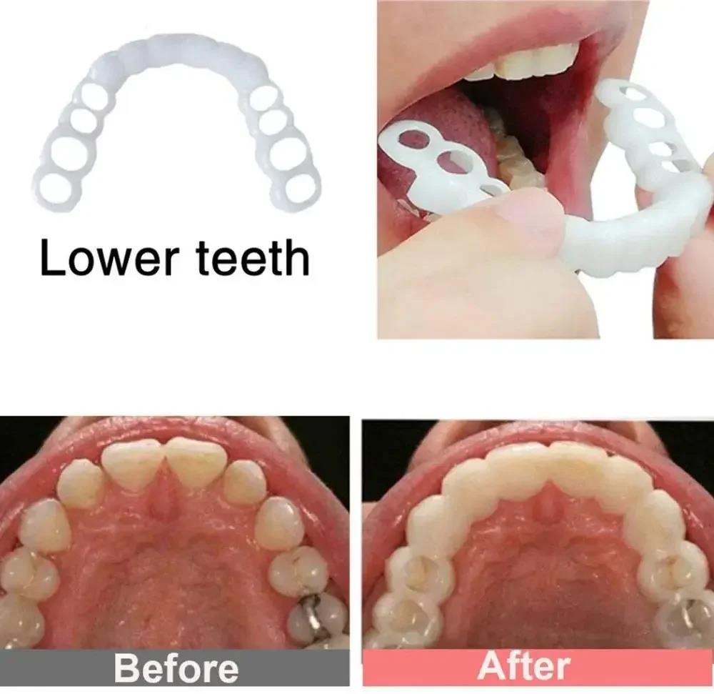 新しい家族の集まりに欠かせない歯のベニア 再利用可能なインス - Teeth Whitening For Photos のレビューと価格