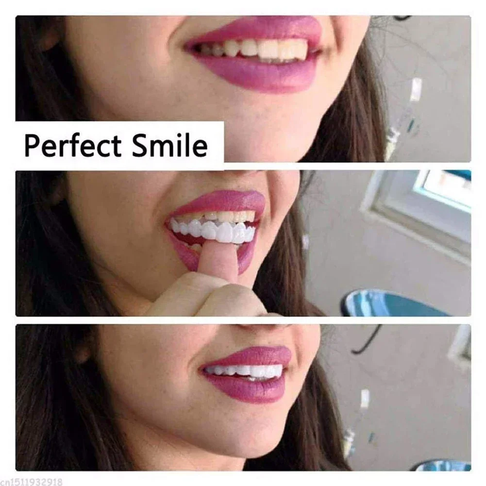 ペットオーナー用歯のベニア 再利用可能 瞬間美白 明るい表情 - Teeth Whitening For Photos のレビューと価格
