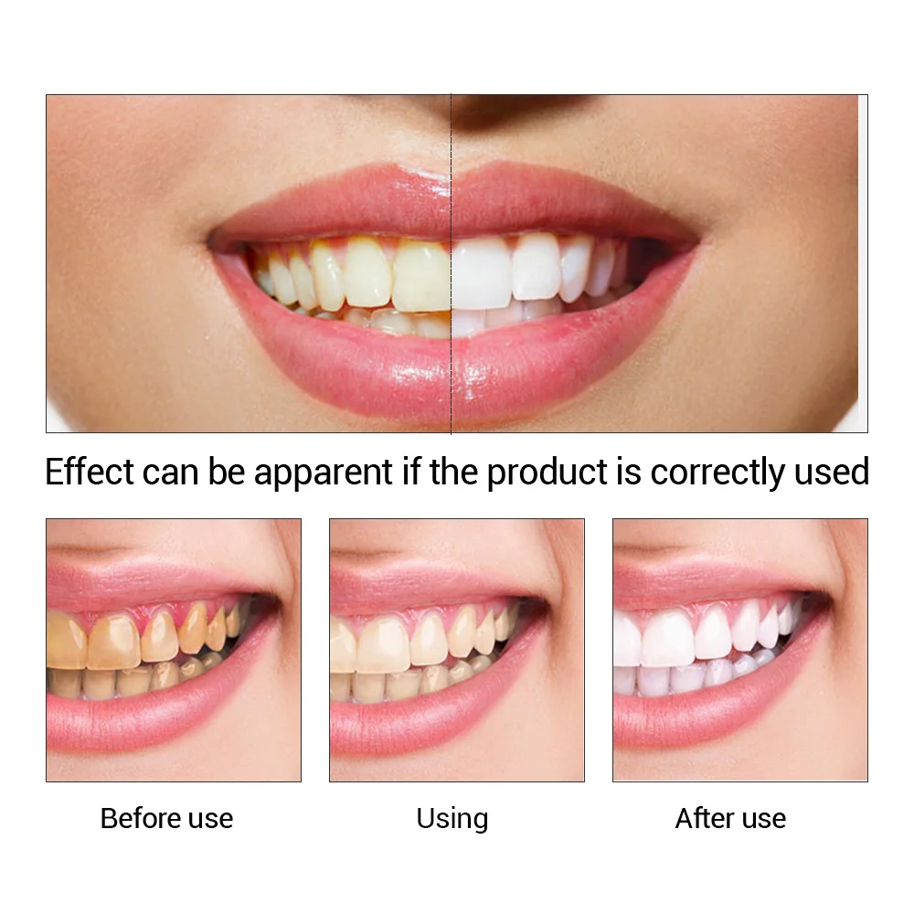 歯のホワイトニングエッセンス,口腔衛生,歯のホワイトニング, - Teeth Whitening Vape のレビューと価格