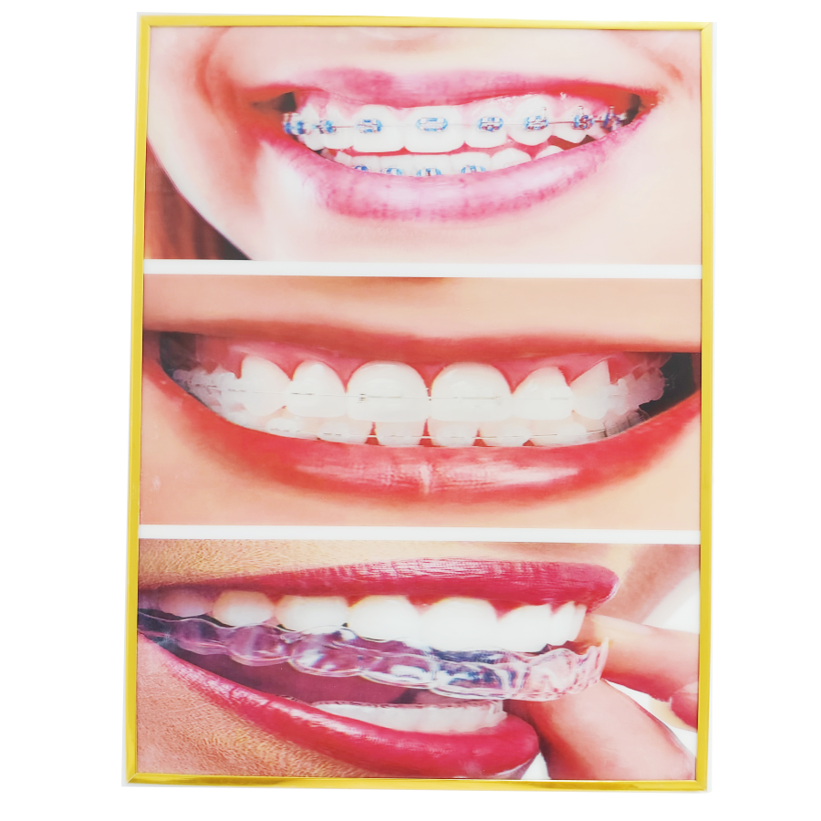 歯科医院/病院の装飾用の装飾的な3D写真壁掛け、美しい歯、歯 - Teeth Whitening For Photos のレビューと価格