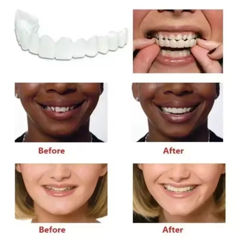 歯のベニア、ホワイトニング、入れ歯、歯列矯正、一時的な義歯カ - Teeth Whitening Vape のレビューと価格