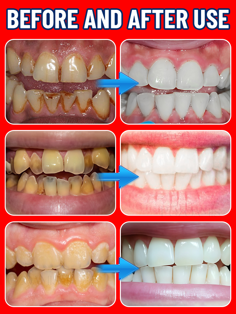 口腔ケア、歯のホワイトニング、黄ばみ、歯垢、虫歯、歯痛の除去 - Teeth Whitening Usa のレビューと価格