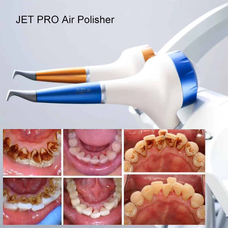 VV デンタルエアポリッシングプロフィーエアフロー口腔衛生ク - Teeth Whitening Usa のレビューと価格