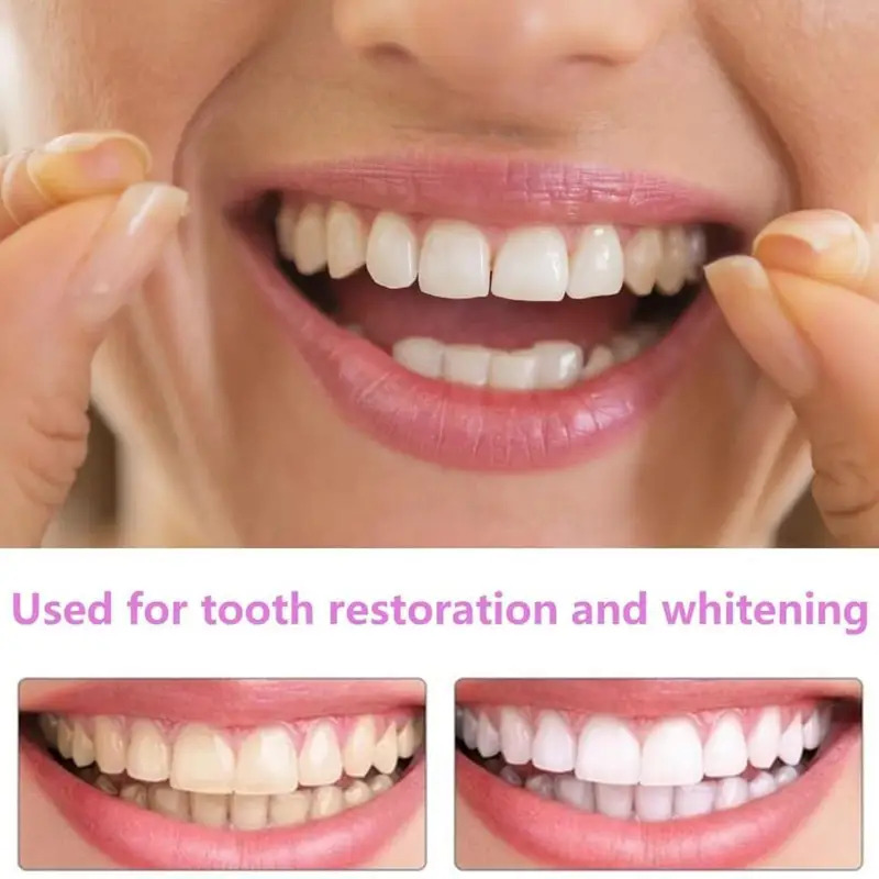 新しいペットオーナー向け歯のベニア 再利用可能 瞬間的な笑顔 - Teeth Whitening For Photos のレビューと価格