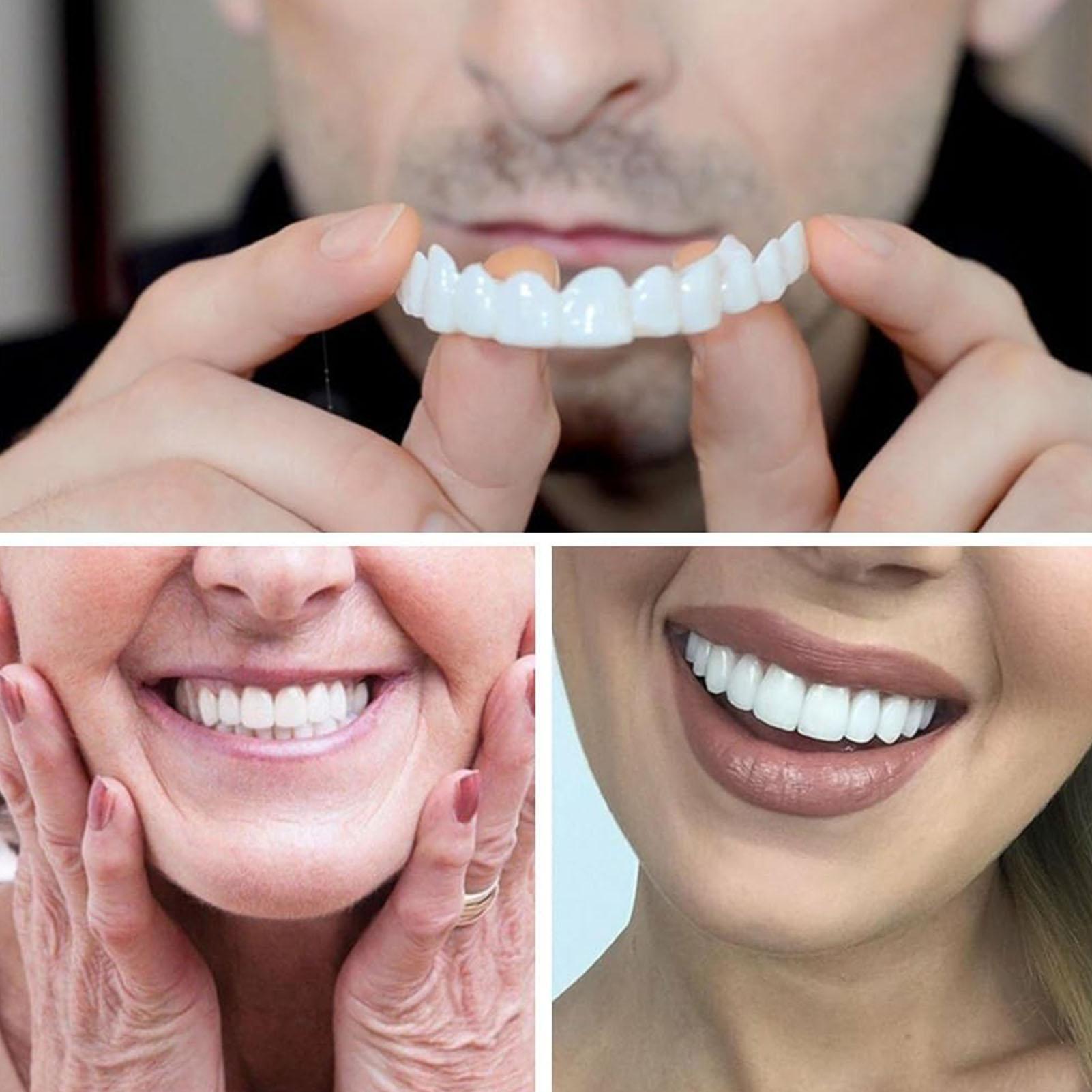 新しいカメラ付きの恥ずかしがり屋さんのための歯のベニア、再利 - Teeth Whitening For Photos のレビューと価格