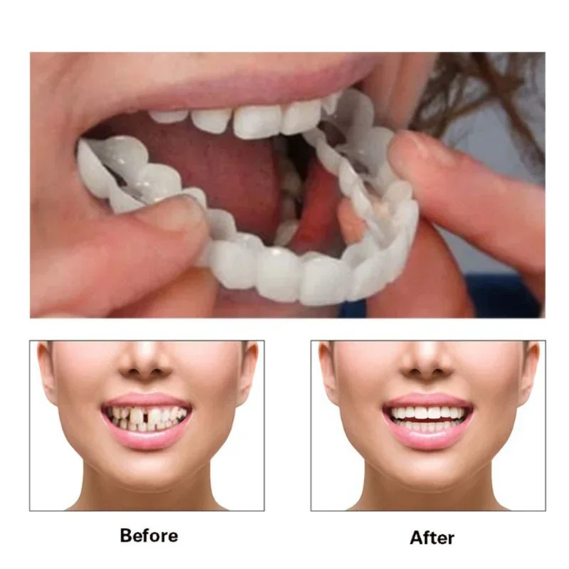 新しい完璧な家族写真用スマイル歯ベニア 再利用可能 瞬間ホワ - Teeth Whitening For Photos のレビューと価格